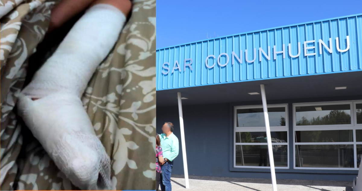 Menor fue inmovilizado con cartón y gasa en SAR de Padre Las Casas: alcalde descarta falta de recursos