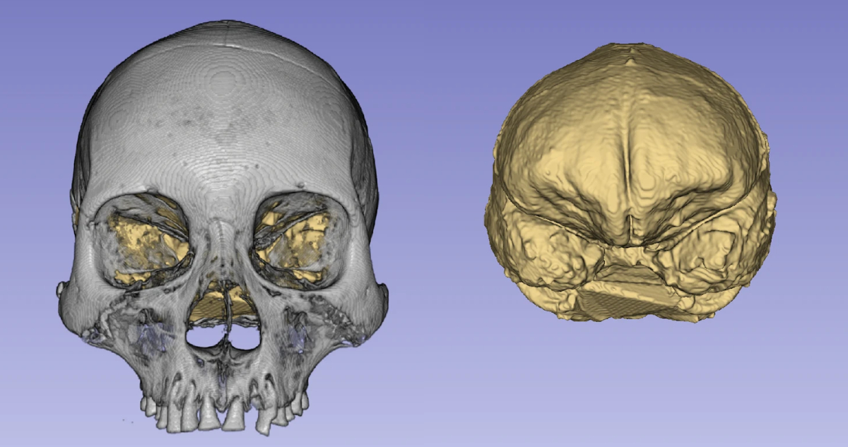 Estudio explica por qué los chilenos somos más altos y cabezones que nuestros ancestros