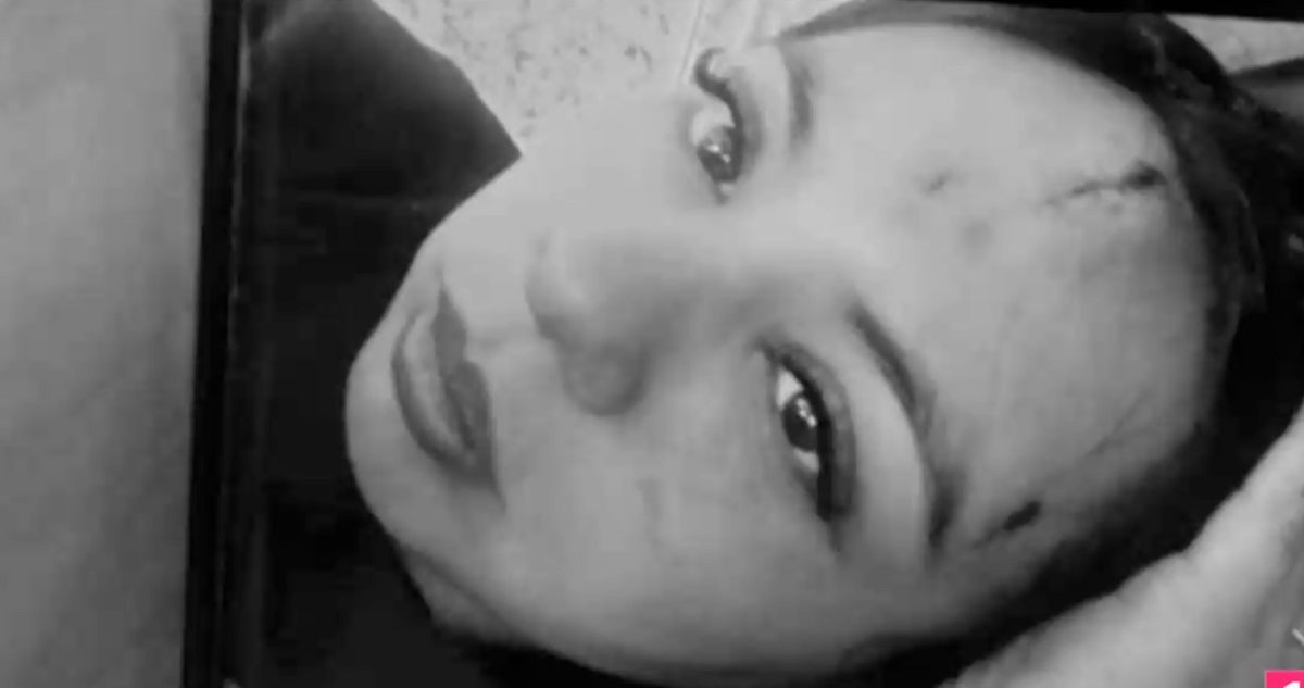 Brutal agresión contra hermana de Krishna Aguilera deja evidentes cortes y moretones en su rostro