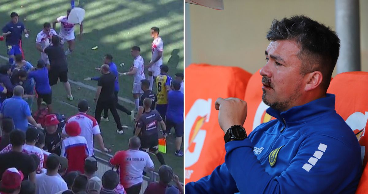 Jairo Coronel, defensor de Copiapó, conoció su duro castigo tras pelea ante la UdeC