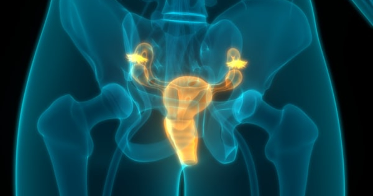 Imagen de un útero para ilustrar nota sobre la vacuna que previene el cáncer de cuello uterino