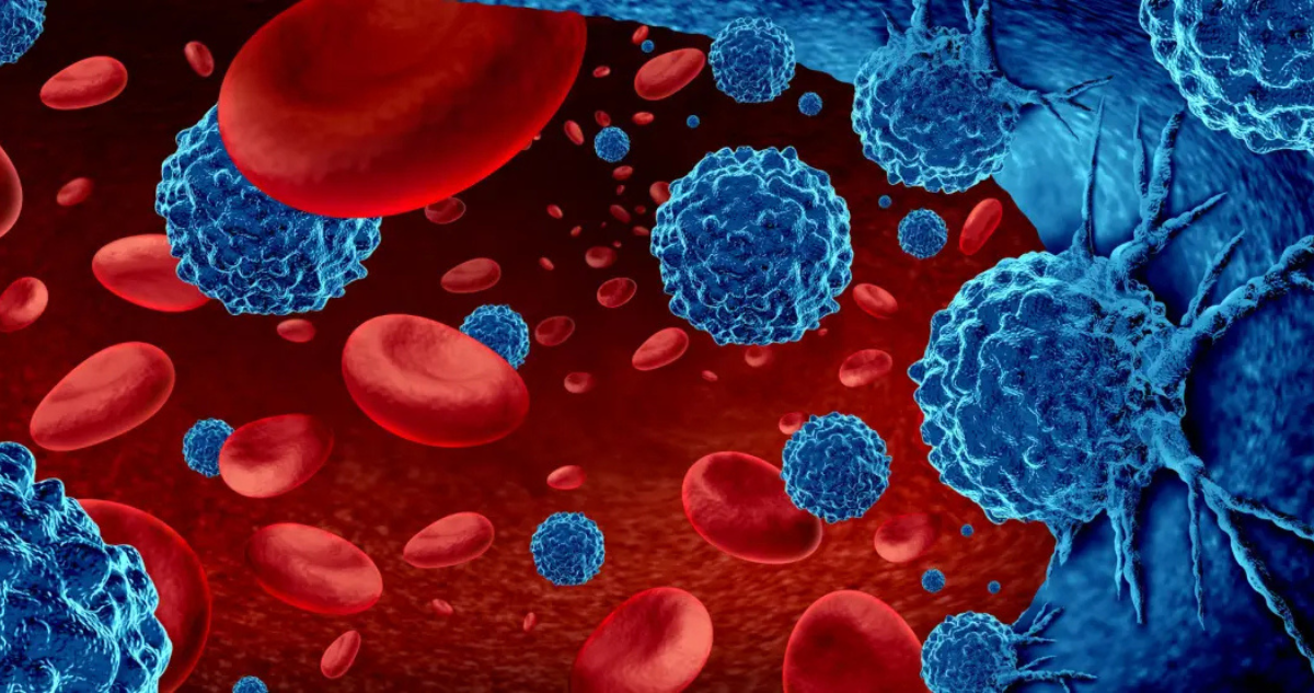 BE-CAR7: La nueva terapia para la leucemia linfoblástica aguda de células T