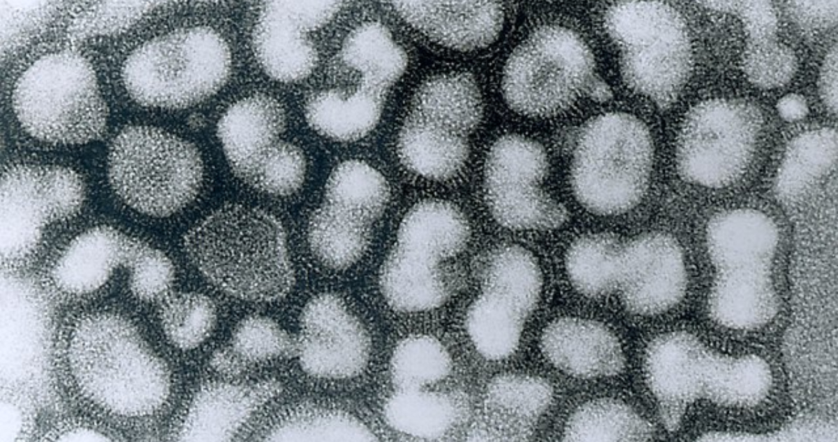 Epidemióloga descarta que influenza H3N2 pueda causar una nueva pandemia