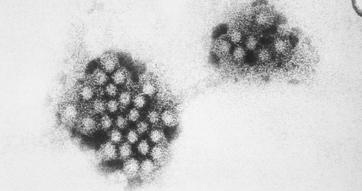 Micrografía electrónica del norovirus