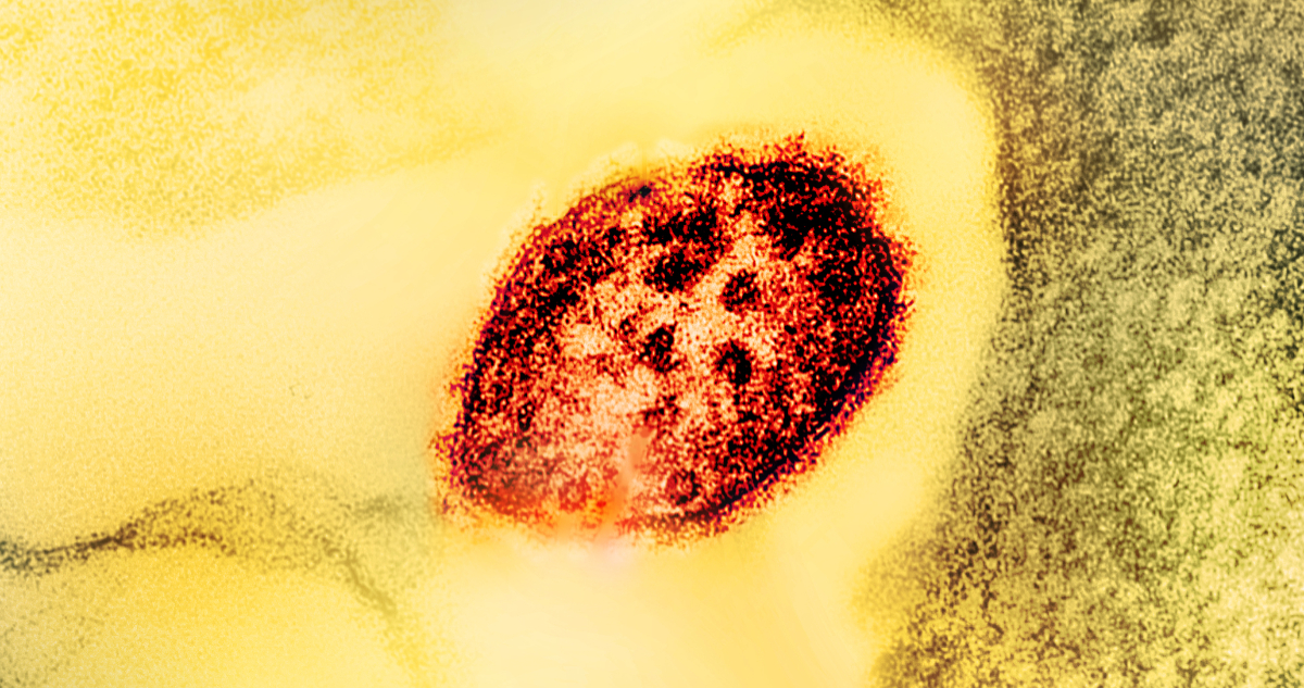 virus del sarampión