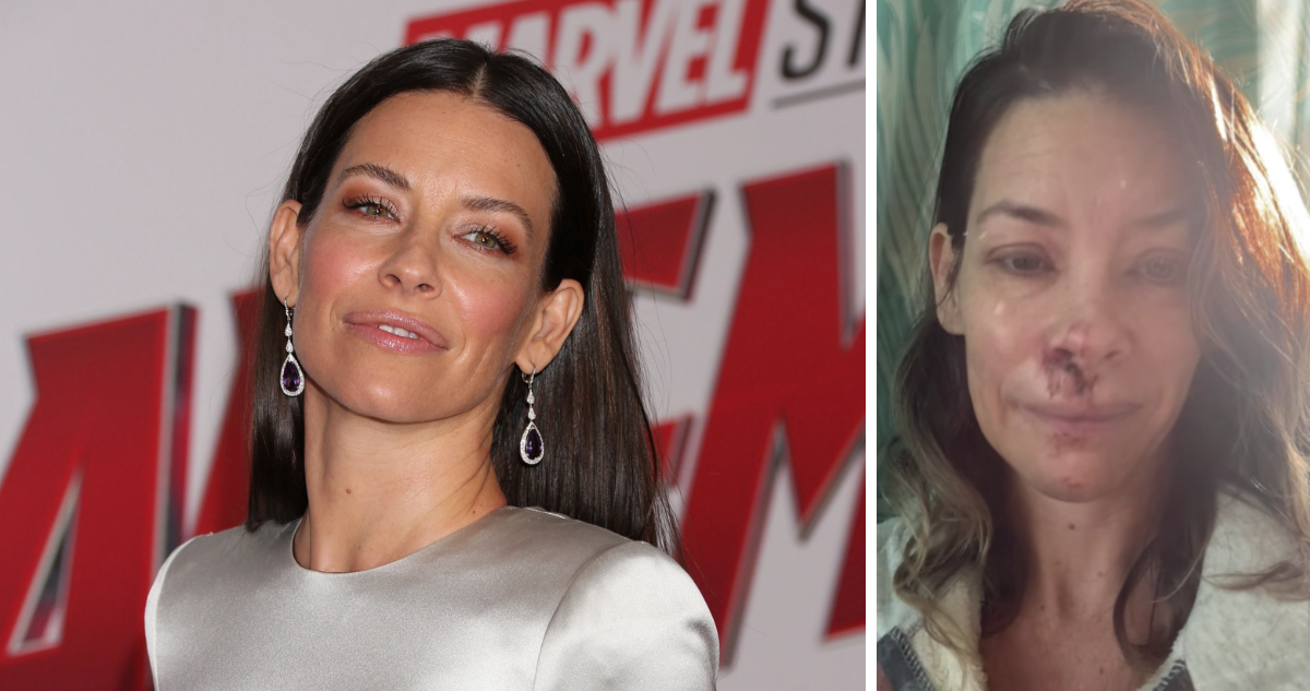 Actriz Evangeline Lilly de Lost y Ant-Man revela que tiene daño cerebral tras fuerte caída