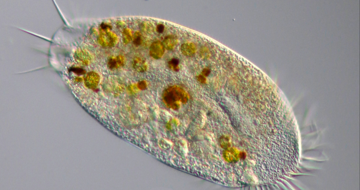 Las amebas peligrosas se están propagando por el mundo, advierten científicos