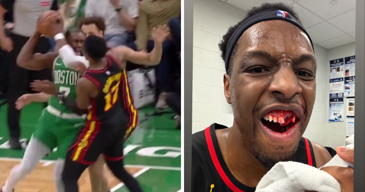Crack de Atlanta queda con un par de dientes sueltos tras fuerte codazo en victoria ante Celtics