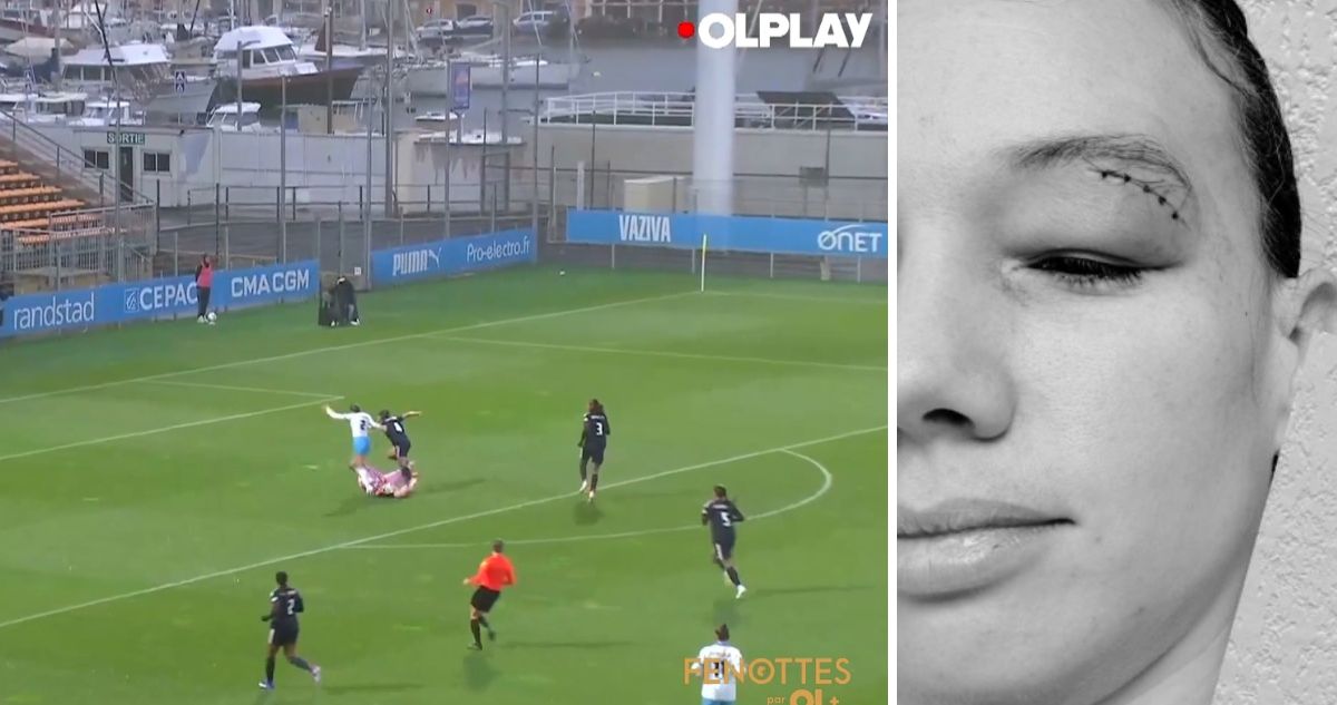 Christiane Endler sufrió durísimo golpe en la cabeza y salió lesionada en Francia.