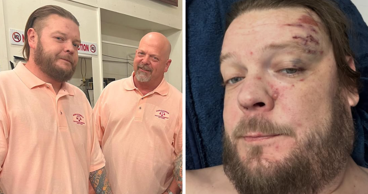 Corey Harrison de “El precio de la historia” sufre grave accidente en moto: tiene 11 fracturas