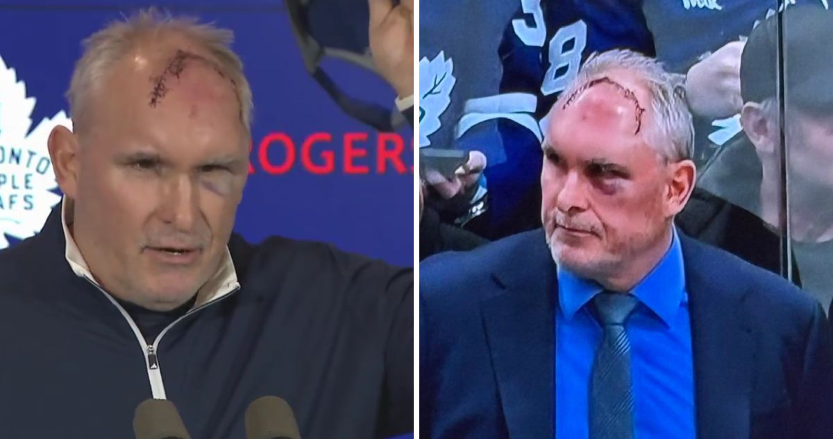 Craig Berube impactó con enorme cicatriz en su cabeza.