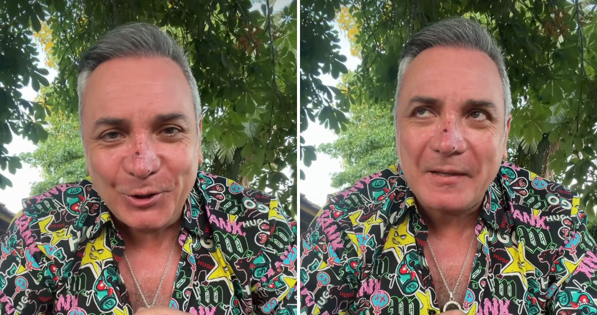 Luis Jara entregó potente reflexión para el Año 2026 tras ser mordido por un perro en la nariz