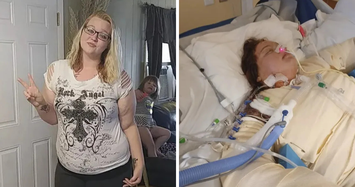 Mujer confesó que su cita la rechazó tras resultar quemada por salvar a su hermana de incendio en EEUU