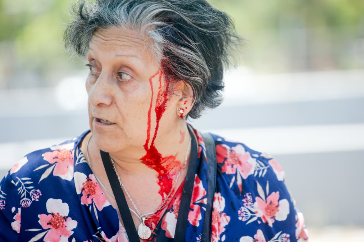 Mujer ensangrentada tras enfrentamiento en el marco del juicio a Claudio Crespo.