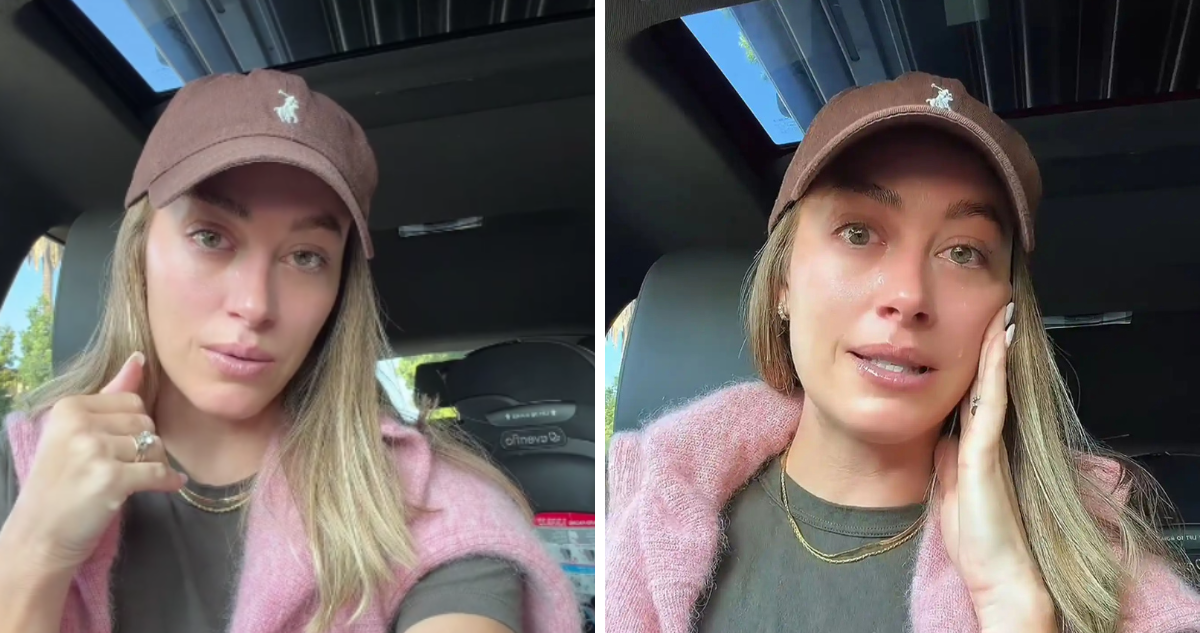 Influencer alerta sobre operarse los párpados en EEUU