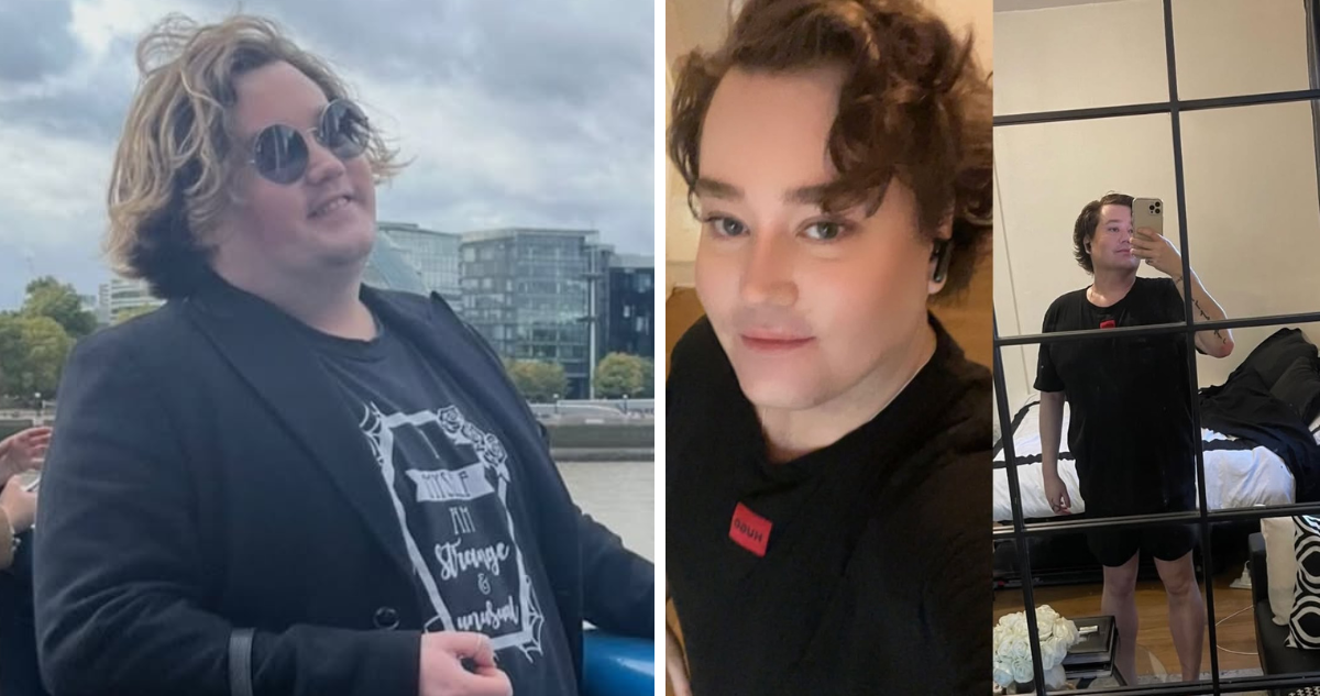 Nicolás Yunge sorprende con radical cambio físico