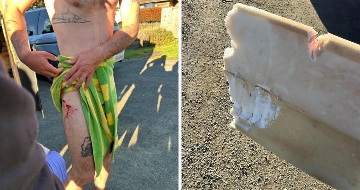 Surfer salva con vida luego de ataque de tiburón en California: herido condujo hasta el hospital