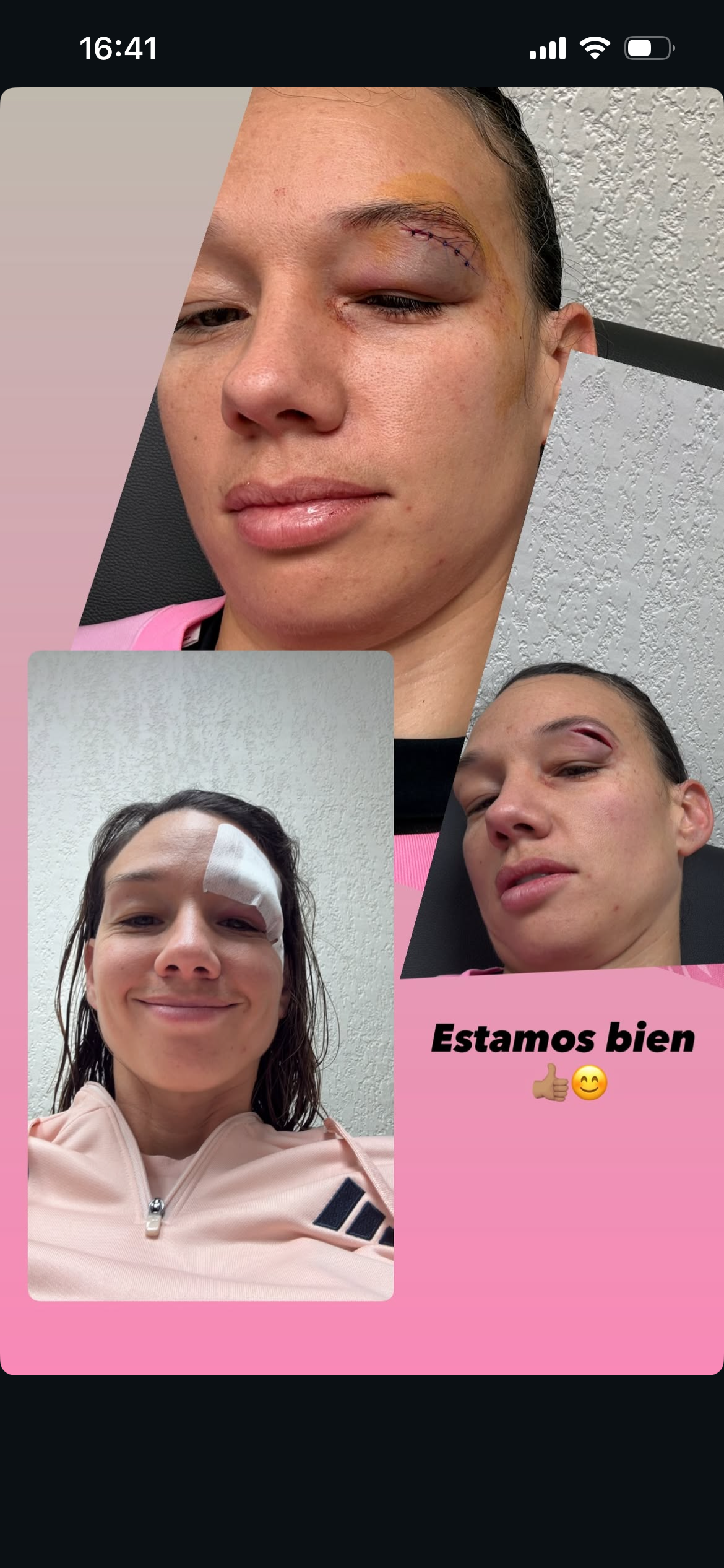 Tiane Endler sufrió lesión en la cabeza en Copa de Francia. 