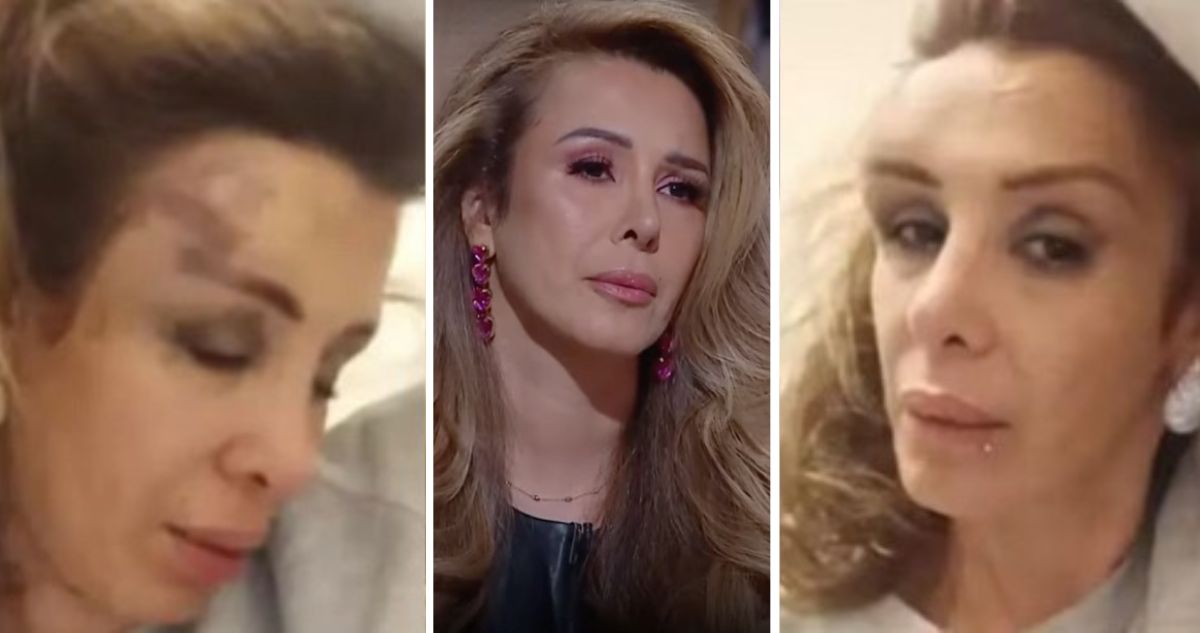 “Botellazo en la cabeza”: Romina Sáez denuncia nueva agresión en su contra dentro de discoteque
