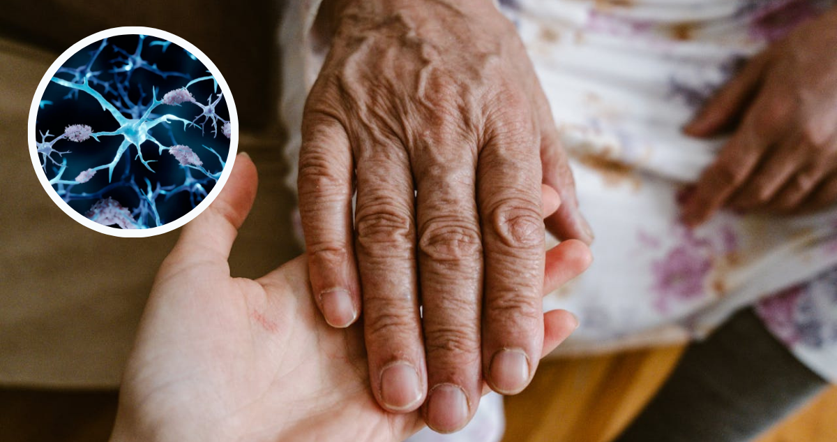 Las personas que tuvieron cáncer rara vez desarrollan Alzheimer