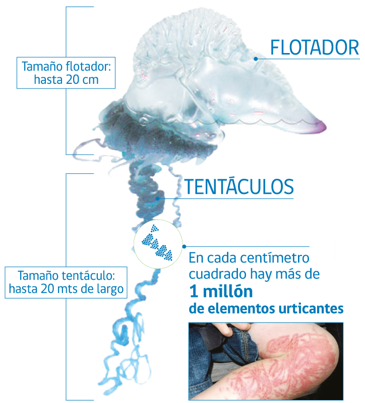 Qué hacer ante la picadura de una fragata portuguesa