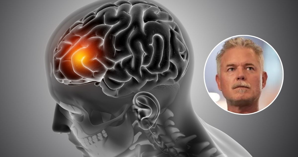 Los sutiles primeros síntomas del ELA: enfermedad neurodegenerativa que padecía Eric Dane