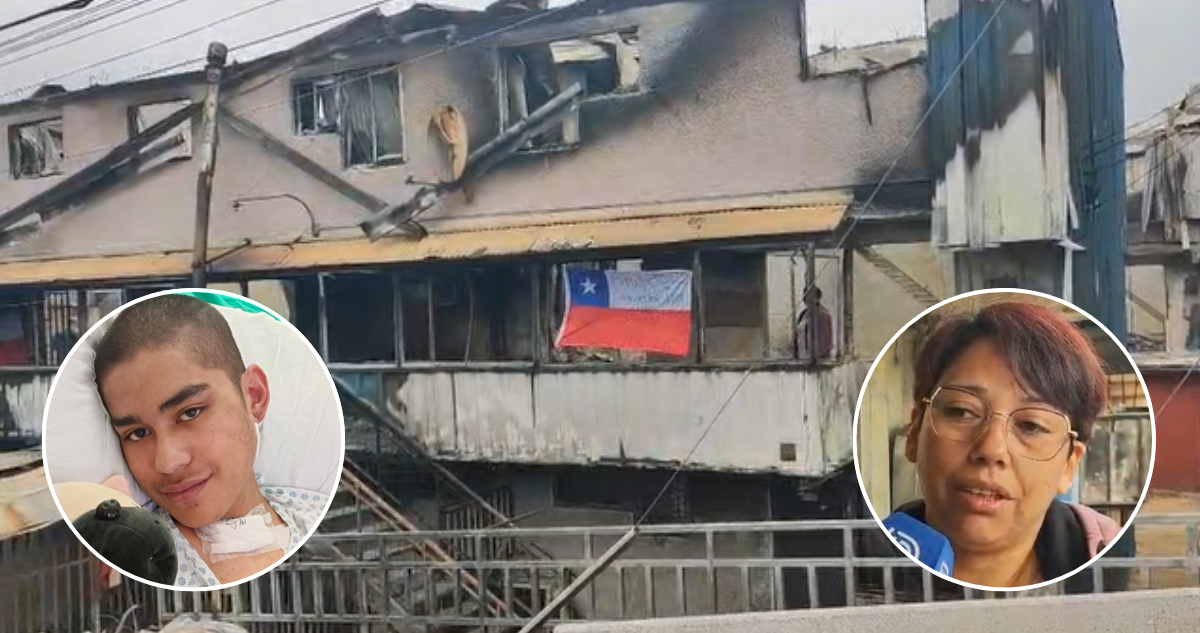 Familia de joven en rehabilitación debido a grave atropello perdió su hogar en incendio de Lirquén