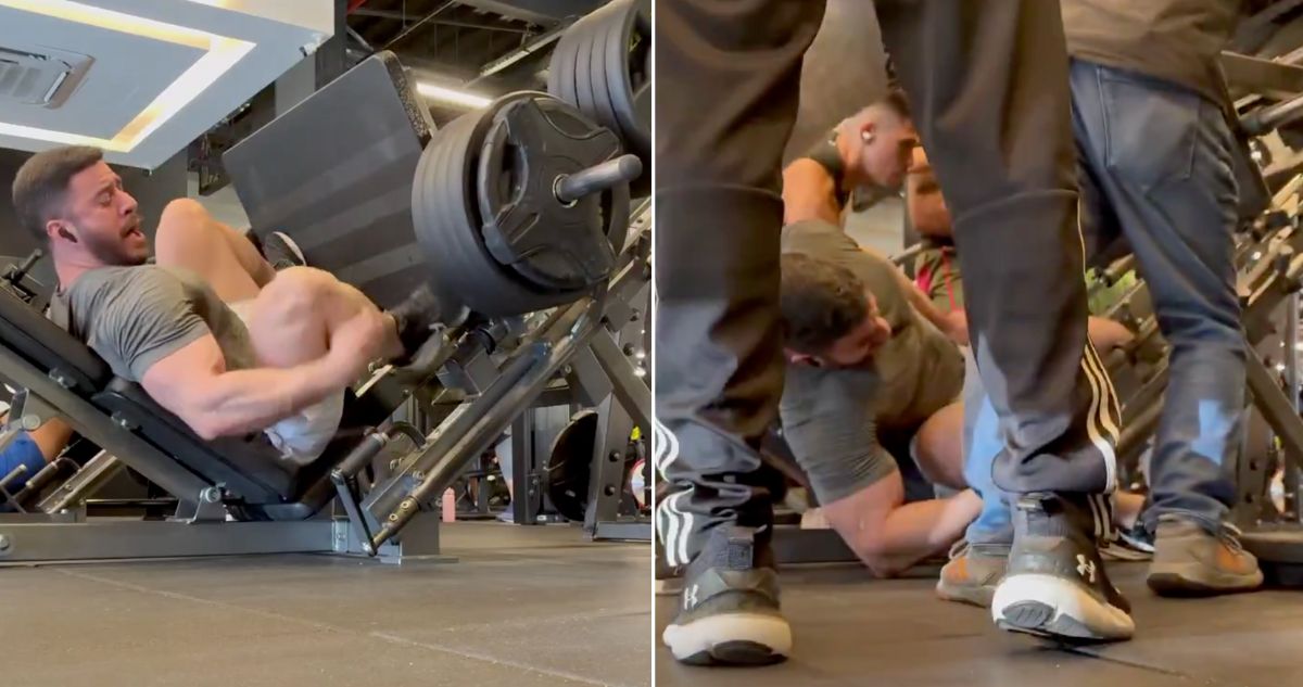 fisicoculturista lesión