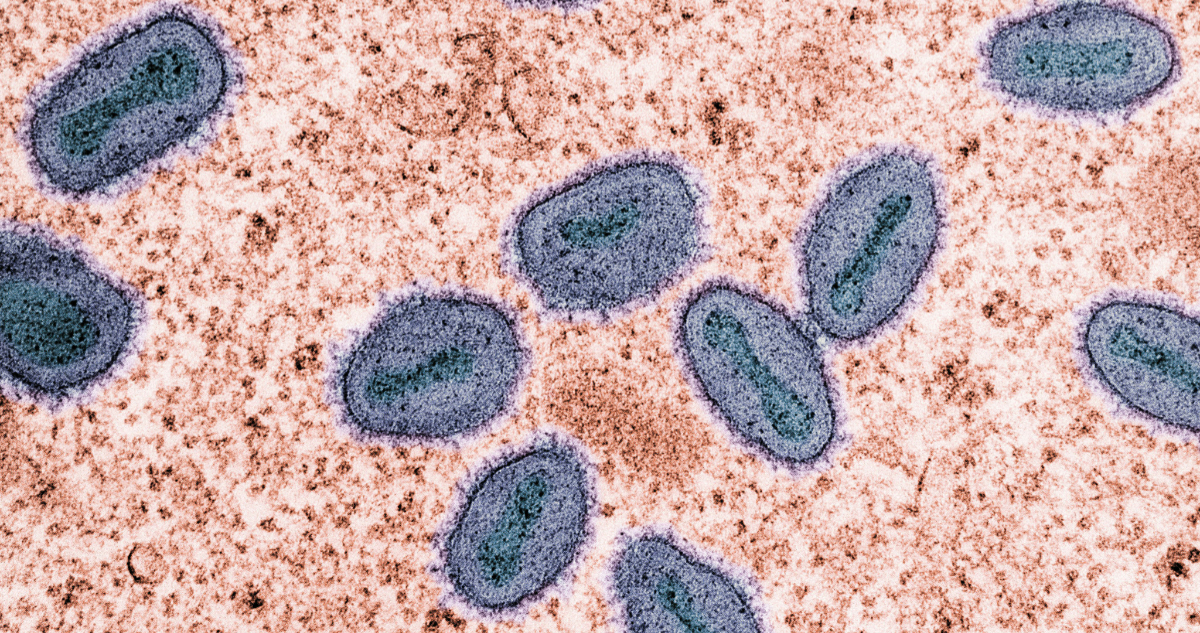 Imagen del virus mpox para ilustrar nota sobre los 3 virus que hay que vigilar este 2026