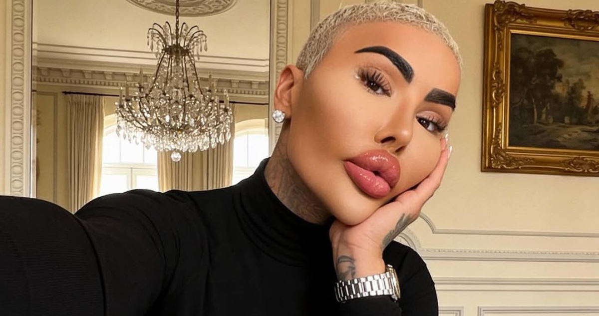 Muere influencer autodenominado “El rey de los labios”: nueva intervención estética habría salido mal