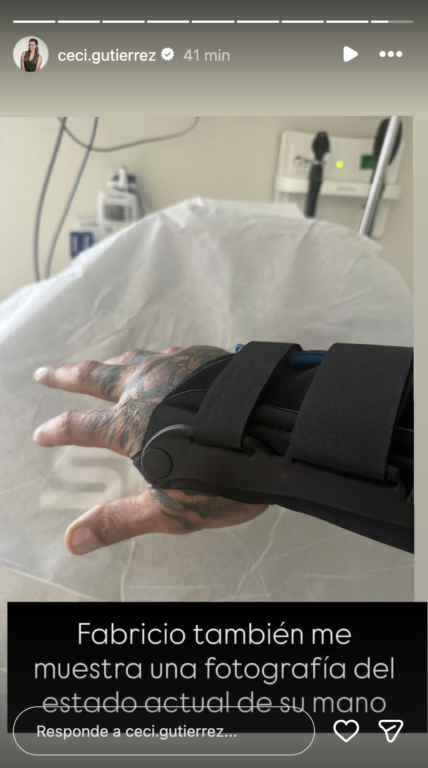 Foto de la mano lesionada de Fabricio Vasconcellos