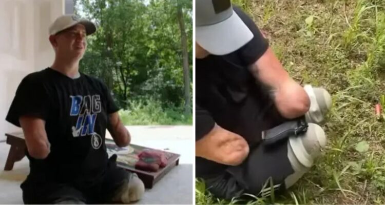 Hombre que perdió sus 4 extremidades es acusado de matar a pasajero mientras conducía en EE.UU