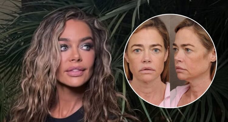 ¿Qué se hizo en el rostro Denise Richards? El sorprendente antes y después de la ex chica Bond