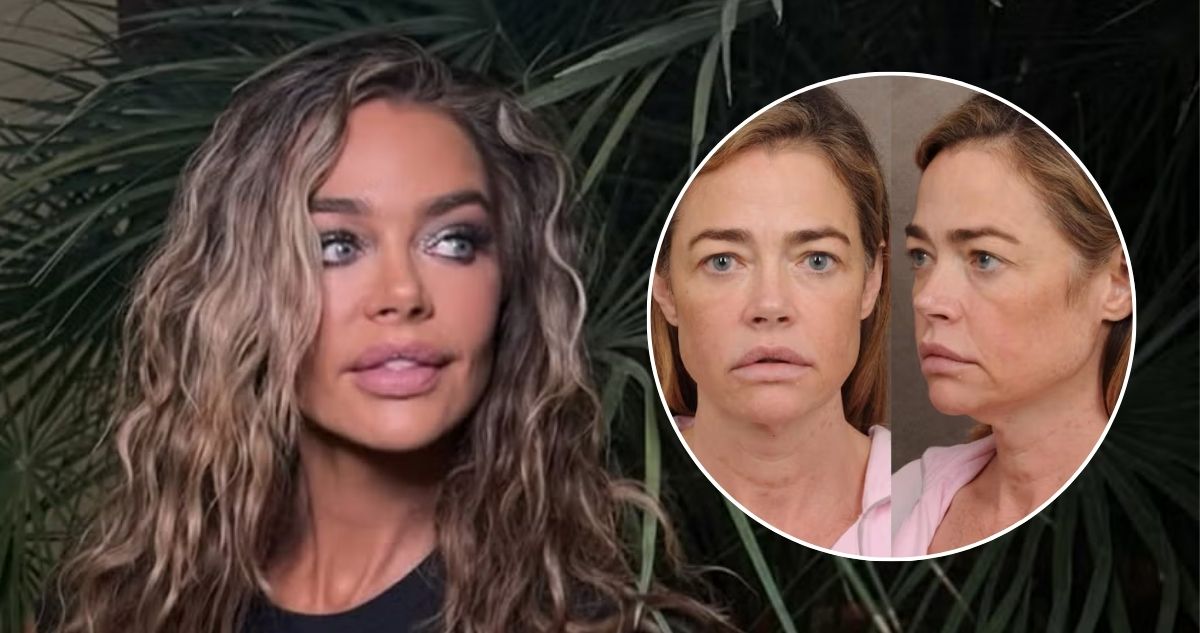 ¿Qué se hizo en el rostro Denise Richards? El sorprendente antes y después de la ex chica Bond