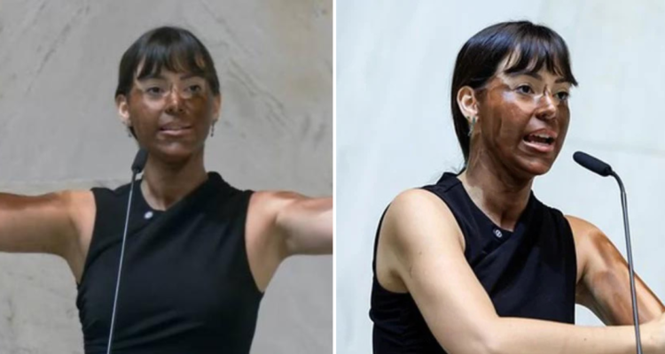 Piden deponer a diputada Bolsonaro en Brasil por racismo: se pintó de negro como crítica a mujer trans