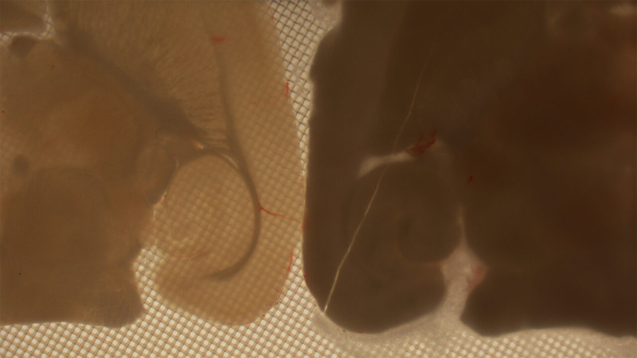 Fotos de tejido cerebral congelado