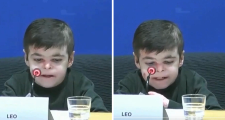 Niño con piel de mariposa