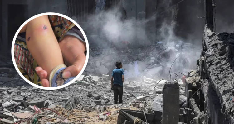 Foto de contexto de niño en medio de zona bombardeada en Gaza. Foto de pierna de bebé torturado