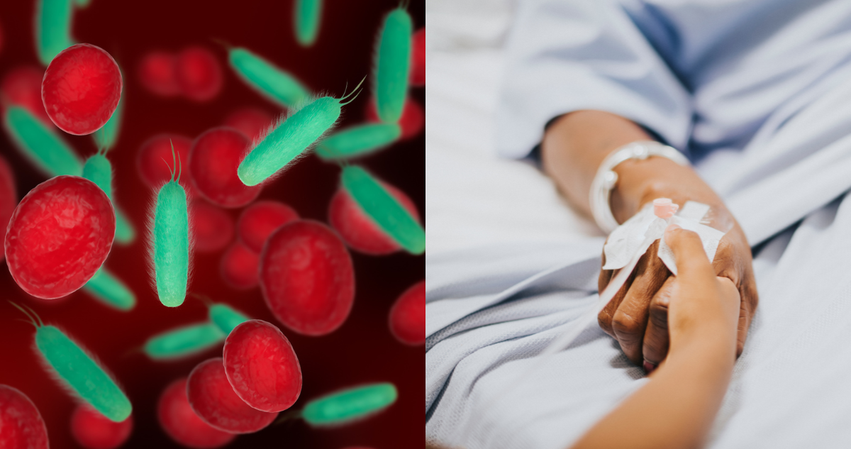¿Una amenaza silenciosa? Estudio advierte que la sepsis podría ser la tercera causa de muerte en Chile