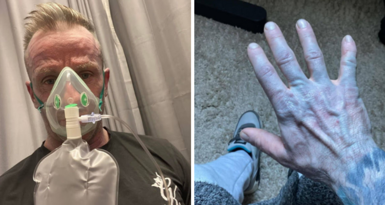 Hombre despertó azul