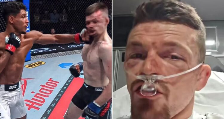 Luchador de UFC se retira de combate por “mandíbula destrozada” y se graba en ambulancia