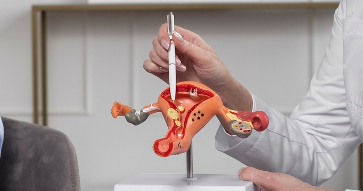 Foto de una maqueta de un útero para ilustrar nota sobre el cáncer cervicouterino