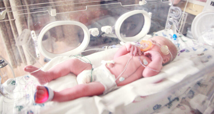 Foto de un bebé recién nacido para ilustrar nota sobre nacimientos prematuros y ftalatos