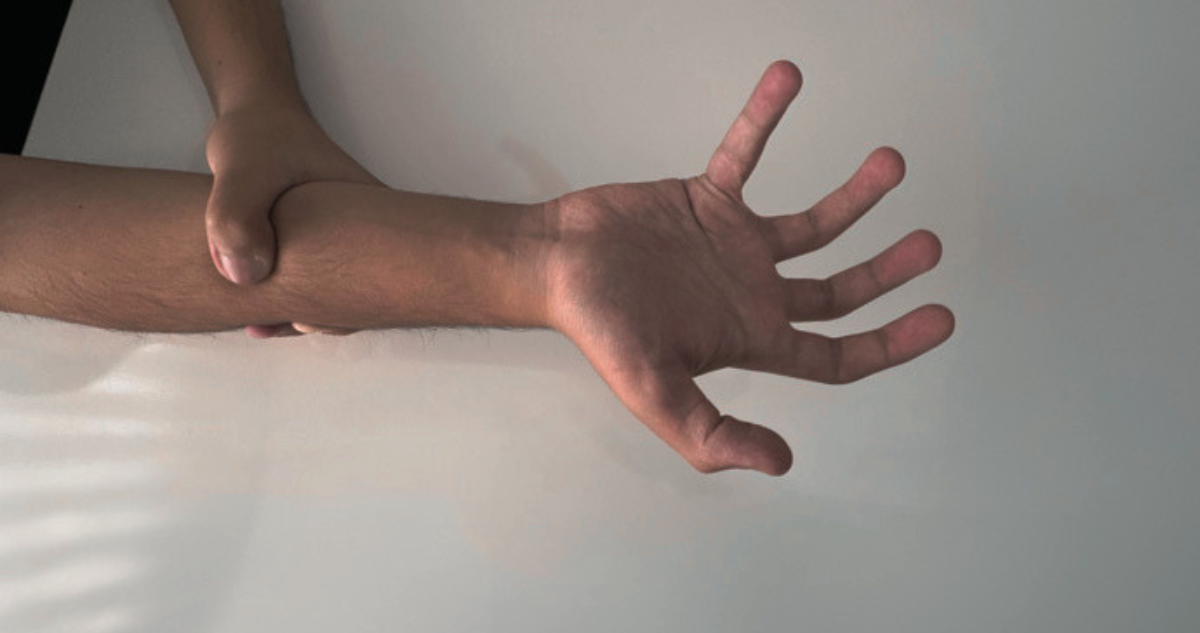 El aterrador síndrome que impide a la persona controlar las acciones que realiza su propia mano