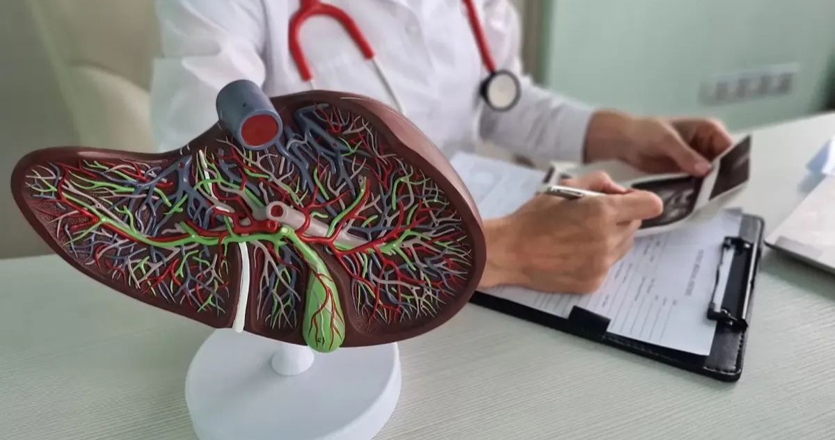 El problema de los silenciosos síntomas de la fibrosis hepática: puede provocar cirrosis y cáncer