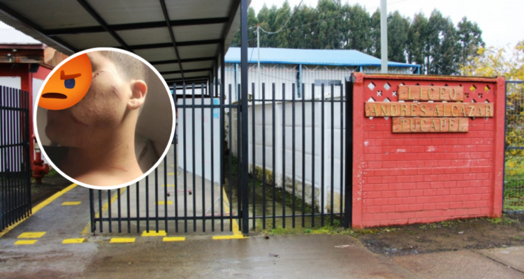 Estudiante de 1° medio termina con diversos cortes tras ser atacado con cuchillo en colegio de Tucapel