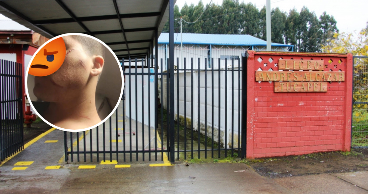 Estudiante de 1° medio termina con diversos cortes tras ser atacado con cuchillo en colegio de Tucapel