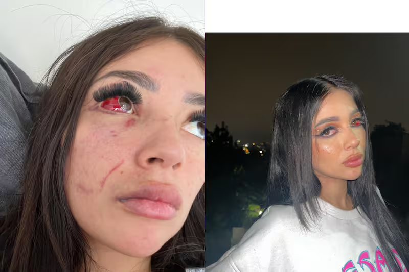 "Quería matarme": Gatita Veve revela imágenes de supuesta agresión de influencer, hijo de Pancho López