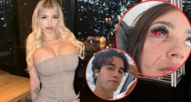 “Quería matarme”: Gatita Veve revela imágenes de supuesta agresión por parte de hijo de Pancho López