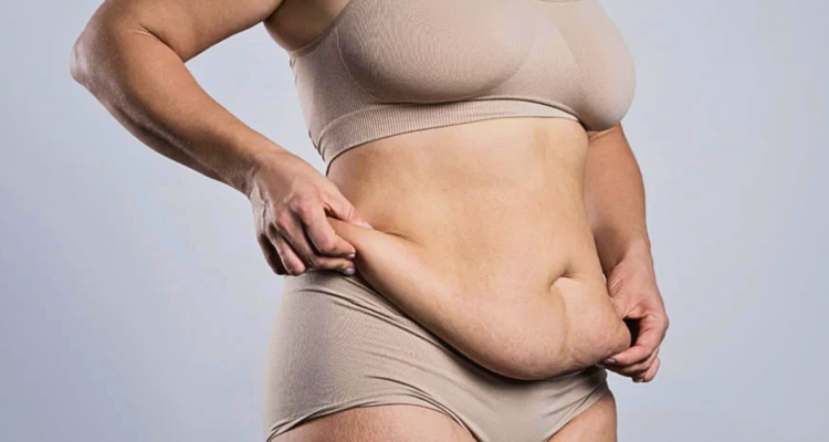 Bono PAD para tratar la “guatita de delantal”: qué incluye, cuánto cuesta y los requisitos a cumplir